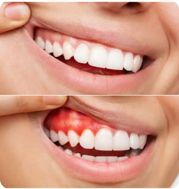 Emergency Dentistry