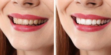 Cosmetic Dentistry